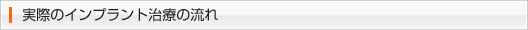 実際のインプラント治療の流れ