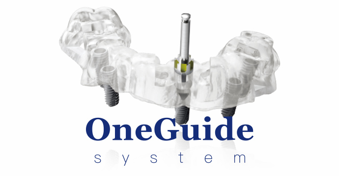 より正確な手術のためのOneGuide System