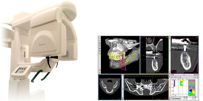 歯科専用CT装置（3次元立体画像撮影装置）
