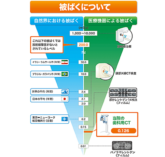 歯科専用CT装置（3次元立体画像撮影装置）