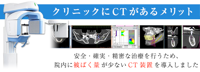 CTがあるメリット
