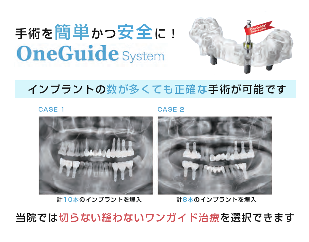 Oneguideシステム