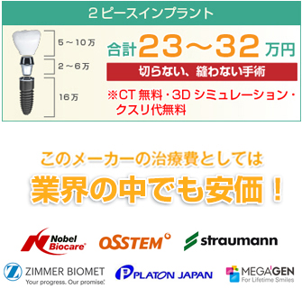 モニター価格につきインプラント治療20％OFF