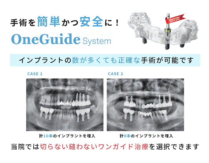 手術を簡単かつ安全に！one Guide System