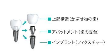 料金画像
