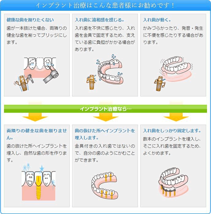 インプラント治療はこんな患者様にお勧めです！