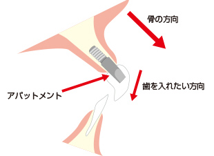 方向への対応