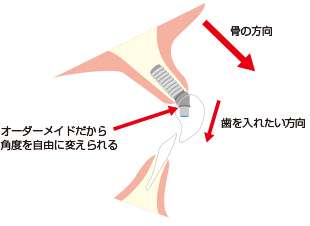 方向への対応