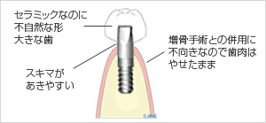 バランス