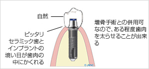 バランス